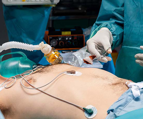 Minimally Invasive Cardiac Surgery