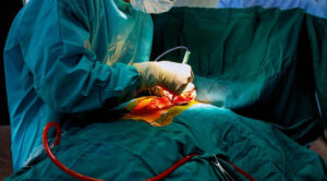 Read more about the article Why Choose Minimally Invasive Cardiac Surgery: Benefits and Limitations